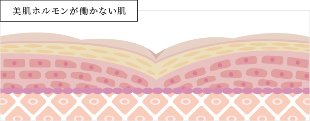 美肌ホルモンが働かない肌